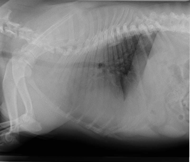 Hypoplastic Trachea