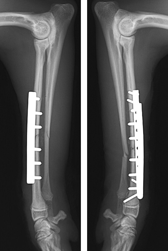 術後前肢レントゲン画像